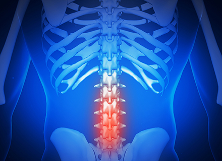 Image of spine patient on the bike