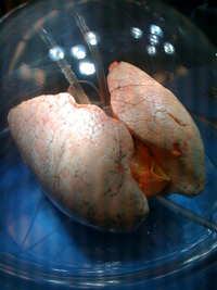 Picture of lungs