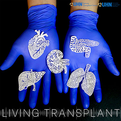 Living Transplant