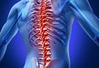 Spine injury
