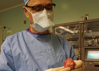 Dr. Robert James Cusimano holds the tumour they took from the McGill University student’s heart