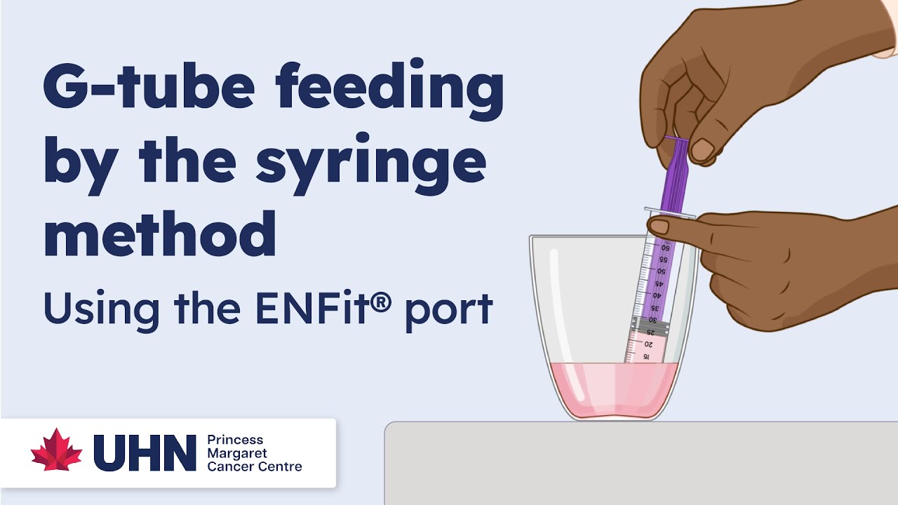 Using the ENFit® port - Syringe Method