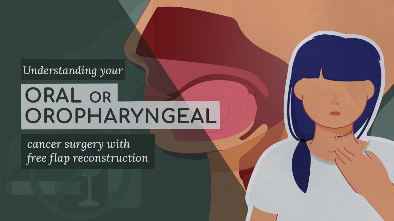 Understanding Your Oral or Oropharyngeal Cancer Surgery