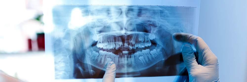health professional looking at xray of human mouth