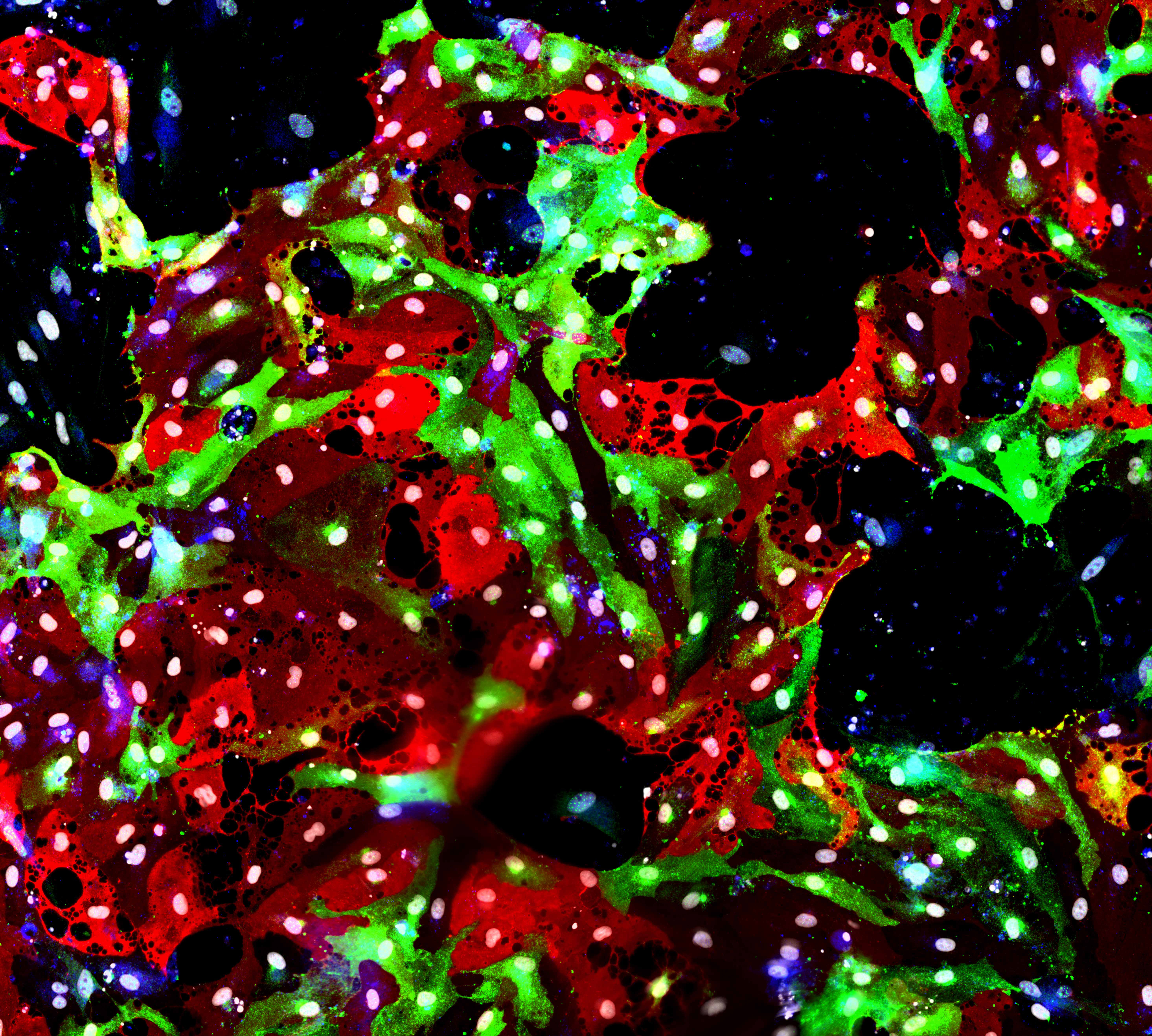 hPSC-derived Liver Sinusoidal Endothelial Like Cells