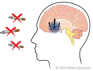 brain stop smoking 