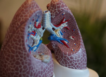 Lungs & Chest