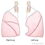 Image of lateral lungs