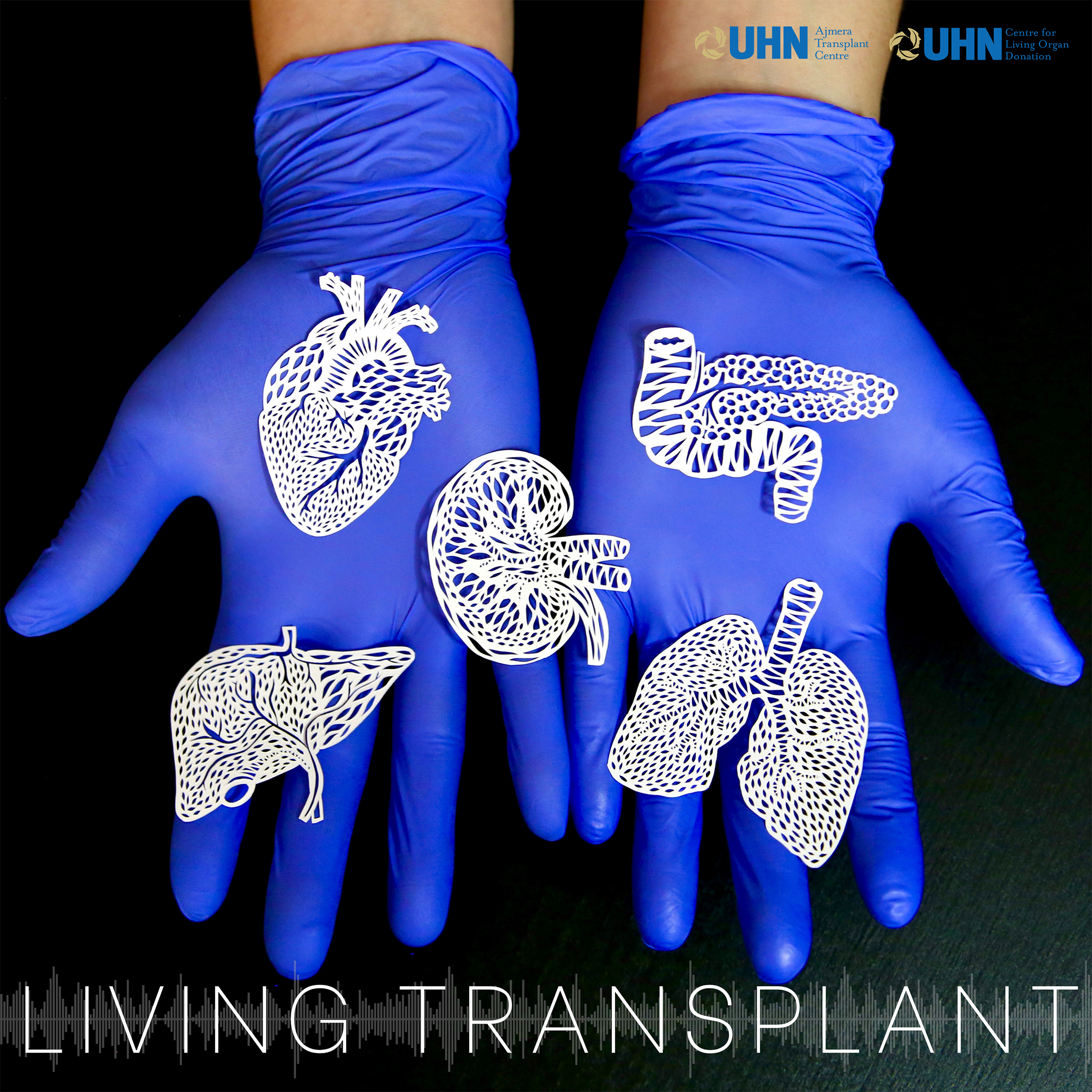 Living Transplant podcast cover