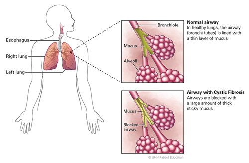 Image of Lung with alveoli