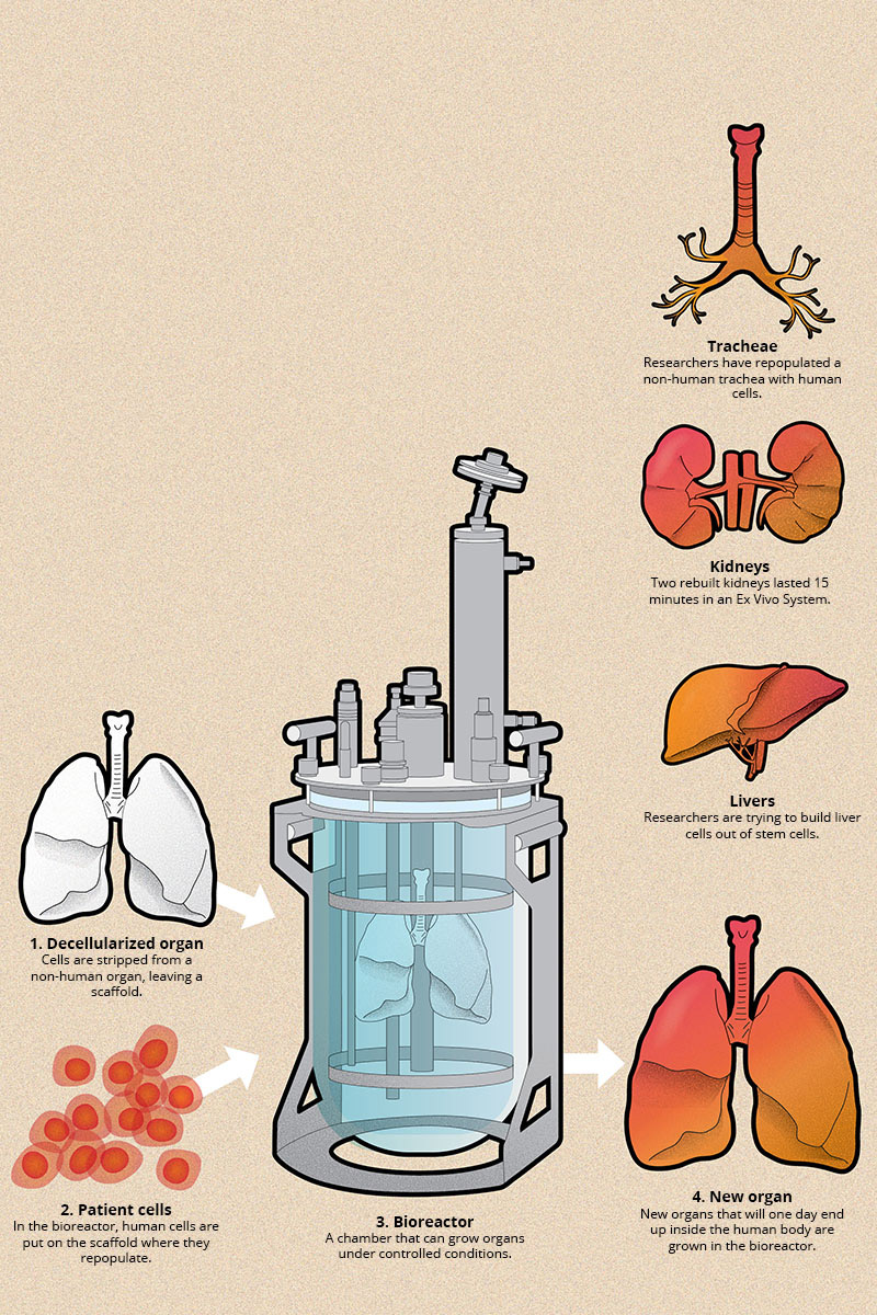 Building better organs infographic
