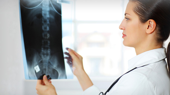 Doctor looking at X-ray of spine