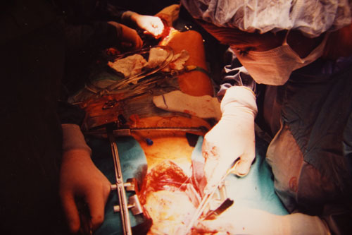 Dr. Stephanie_Brister in surgery.jpg