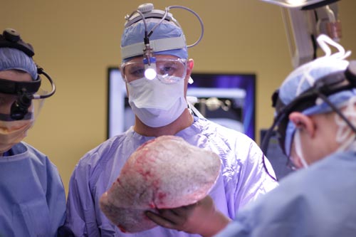 Dr Marcelo Cypel holds lungs before transplanting them