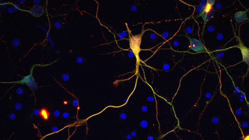 cultured neuron expressing the protein a-syn 