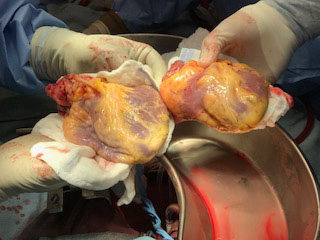 Two hearts held in hands 