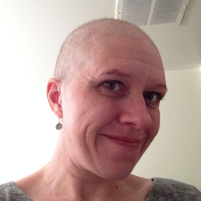Image of Dawn Murphy  with no hair.
