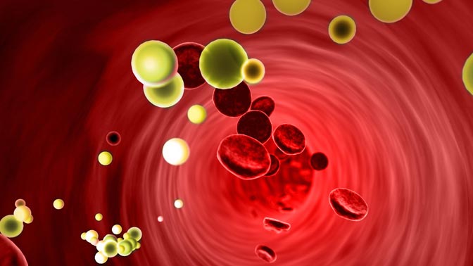 Slide of fat molecules found in blood