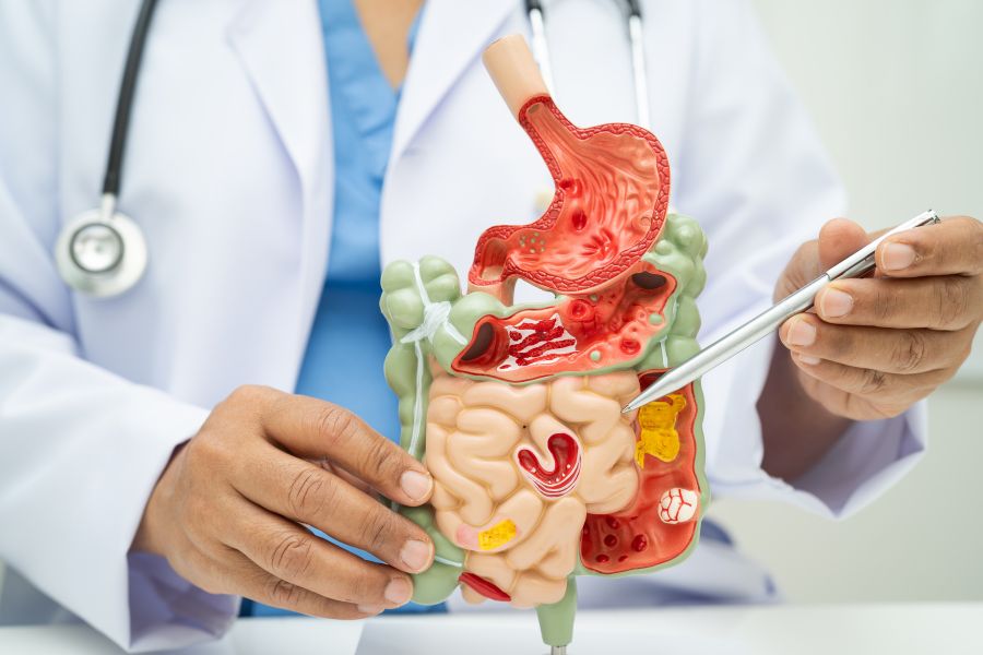 Doctor holding a small model of the digestive system