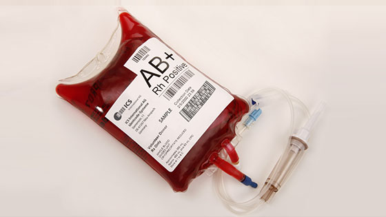 Photo of blood bag