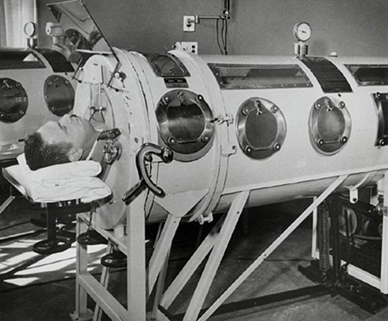 Man lying in an iron lung