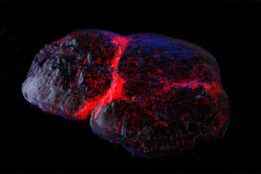 Lymph Node with Macrophages