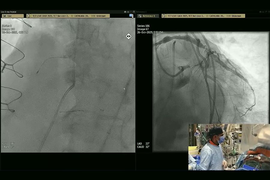 Dr. Sanjog Kalra's live case snap