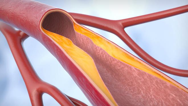 graphic of arteries
