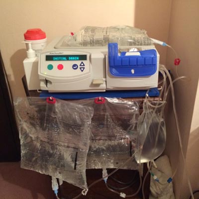 Peritoneal dialysis machine 