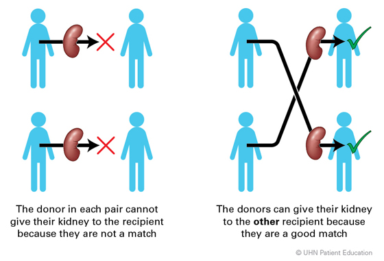 Image of Kidney paired exchange