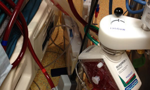 part of the artificial lung technology ECLS.jpg