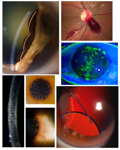 Image of Collage of eyeball shots